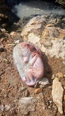 Aborted baby found in floodwaters following heavy rain in Accra, Ghana.